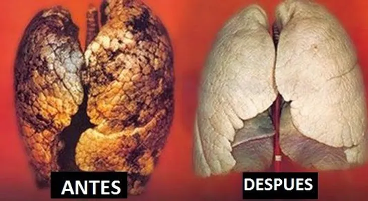 En 72 horas: Cómo purificar tus pulmones 