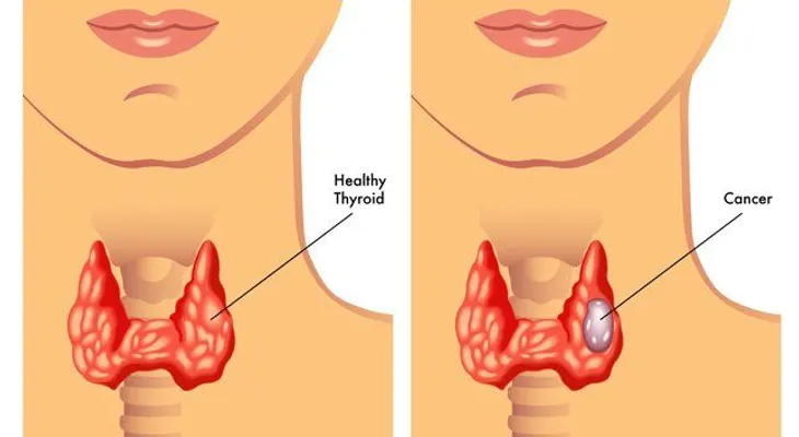 Una mujer se cura su propio cáncer, técnica para alisar el cabello; un vegetal que devuelve la visión, el mejor remedio para recuperar la flacided