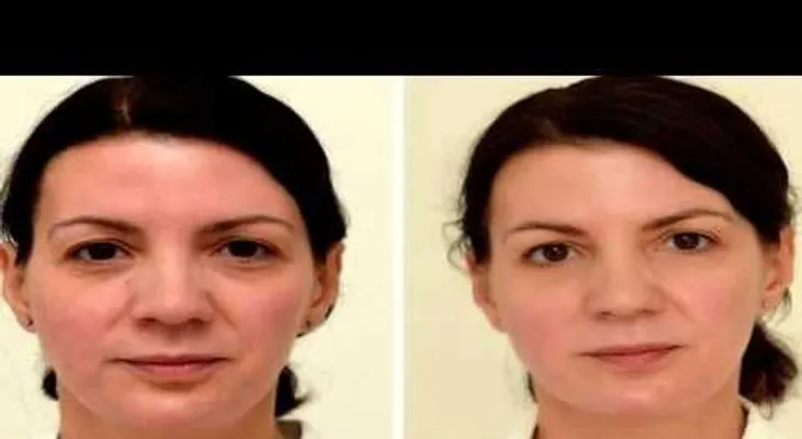 Comprobación científica: tres litros diario de agua y mira como quedó mi rostro (VIDEO)