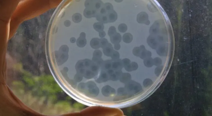 La OMS urge a hallar nuevos antibióticos para 12 superbacterias