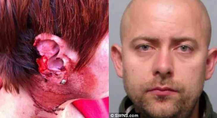 Le arranca un pedazo de oreja a su esposa