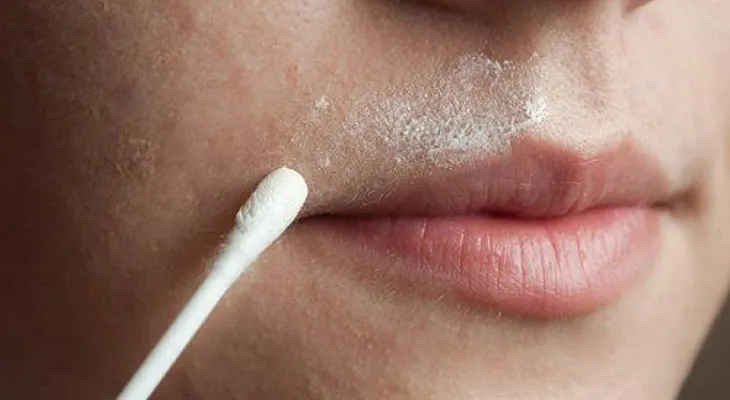 3 soluciones para remover el vello facial