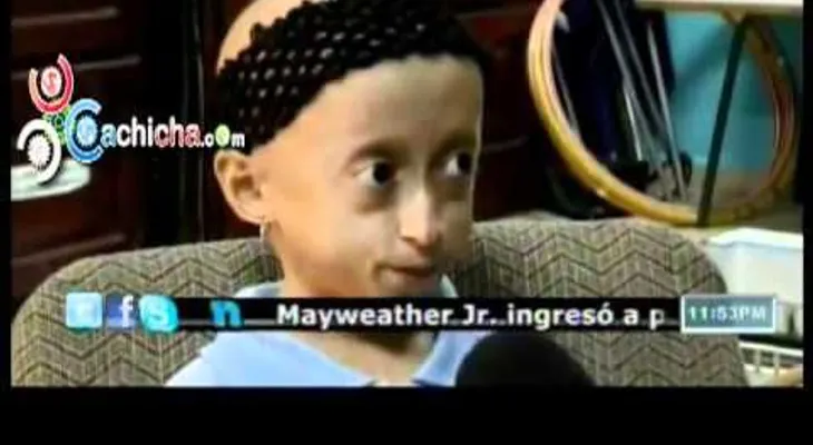 Una niña tiene rara enfermeda que la hace envejecer (VIDEO)