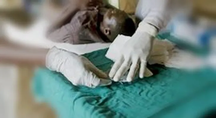 Dispositivo israelí permite circuncidar a 700.000 ruandeses y prevenir el SIDA.