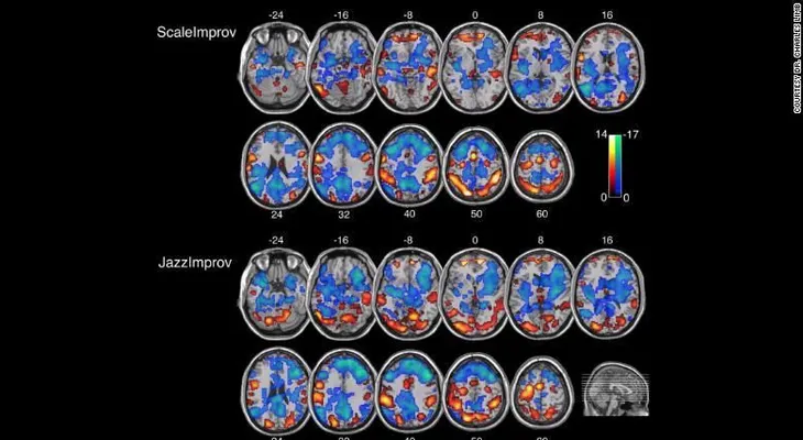 Jazz y tu cerebro: ¿la clave de la creatividad?