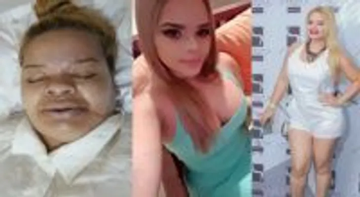 Una joven pierde la vida en una intervención quirúrgica y lo que dice el tío es ESCALOFRIANTE