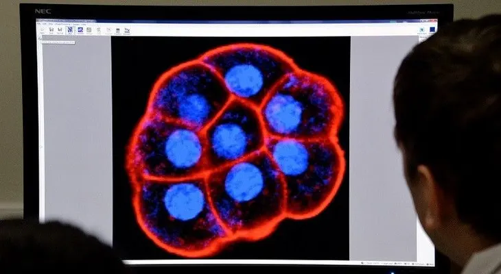 Cerebro bajo LSD: así son las primeras imágenes que muestran los cambios tras consumir la droga