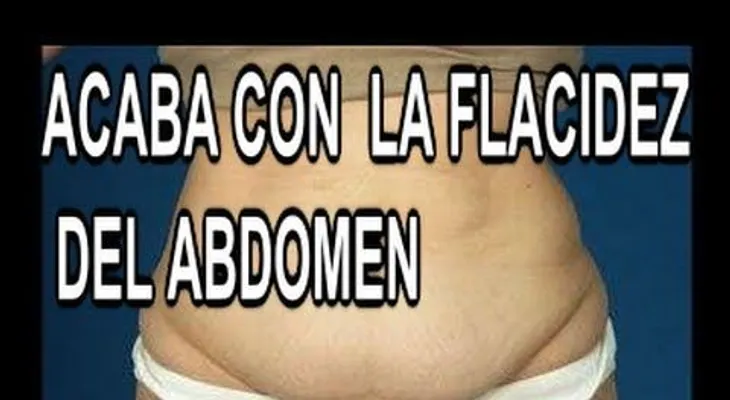 Piel colgada luego de perder 160 libras (Video)
