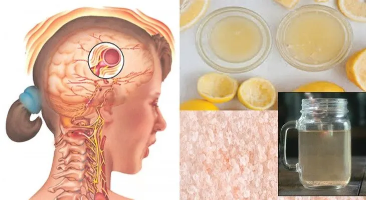 Bebida que hace desaparecer tu migraña en 10 minutos!