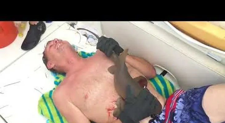 IMPACTANTE: Un tiburón muerde a un hombre en el vientre y no lo suelta