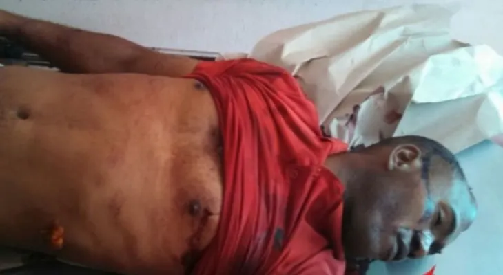 Un hombre mata a otro a martillazos y puñaladas por el "Amor" de una mujer