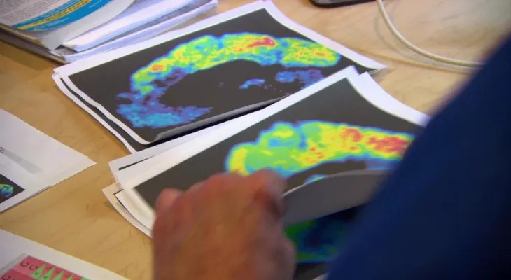 Cómo afrontar el Alzheimer, epidemia del siglo XXI