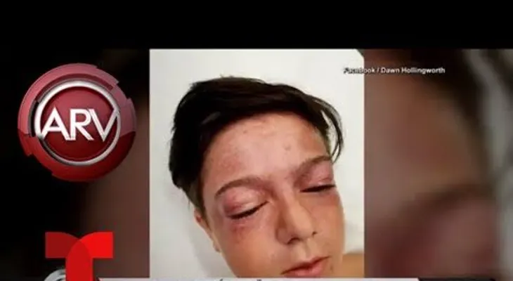 Un niño queda con lesiones cerebrales tras someterse a peligroso reto viral