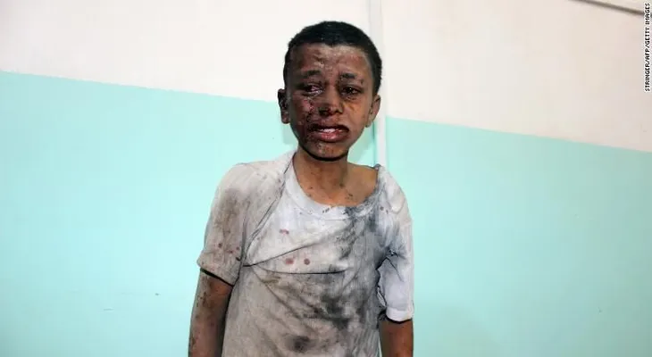 Los niños que murieron en Yemen estaban hablando y riéndose felices por su salida de campo apenas horas antes del ataque aéreo