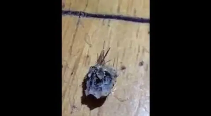 ADVERTENCIA IMAGEN FUERTE: ¡le sacan maraña enorme de pelusa del ombligo!