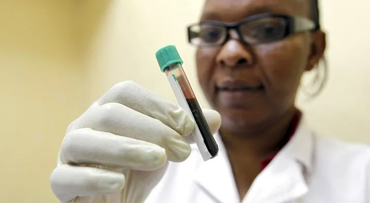¿Hallan en la sangre humana una llave para vencer al VIH?