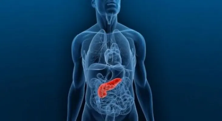 Tratar el cáncer de páncreas con electrodos