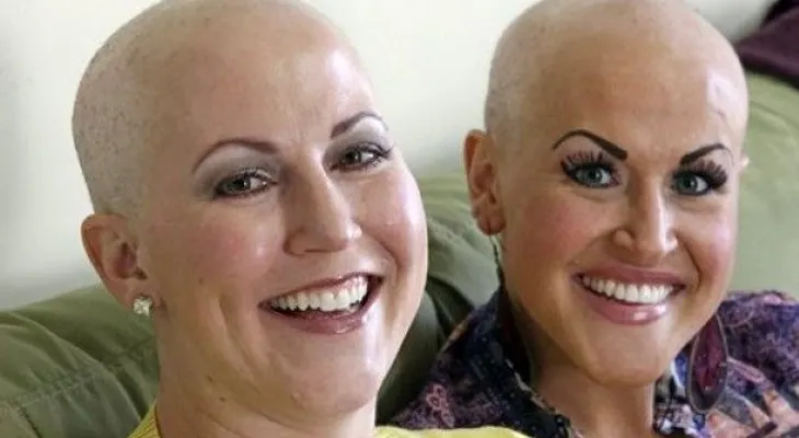 Diagnostican cáncer de mama a dos jóvenes hermanas en EEUU