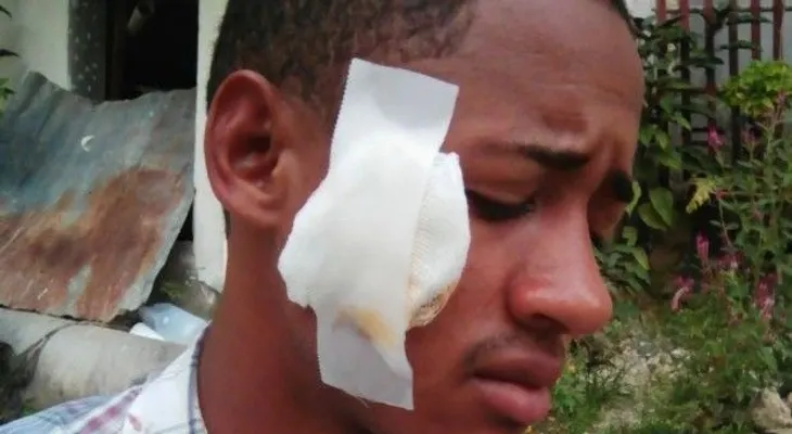 Familiares de joven denuncian fue golpeado por policías en Los Alcarrizos