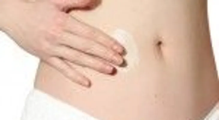 ¡Buenas nuevas! Consejos para evitar las estrías en tu cuerpo