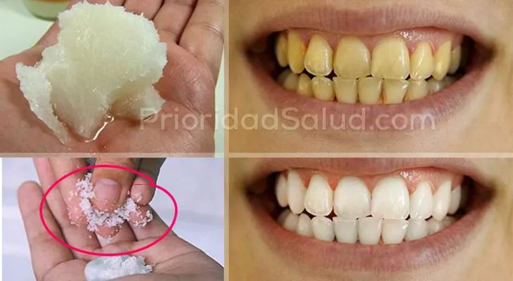 Esta es la mejor receta para blanquear tus dientes amarillos; no será necesario la pasta dental