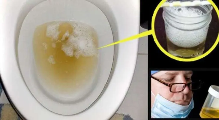 Si orina más espumoso de lo normal acudir URGENTE donde un médico 
