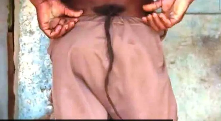 Video: Impresionante, un hombre tiene una cola y trepa como un mono 