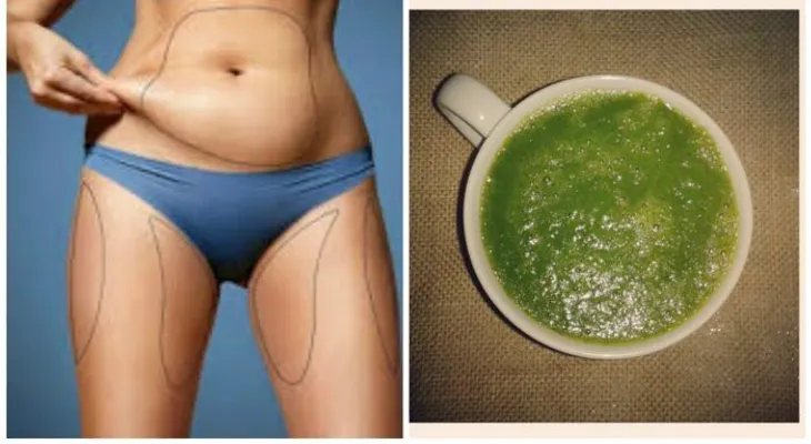 Médico naturista recomendó este remedio a una amiga. En 1 mes resultó mejor que hacerse una cirugía