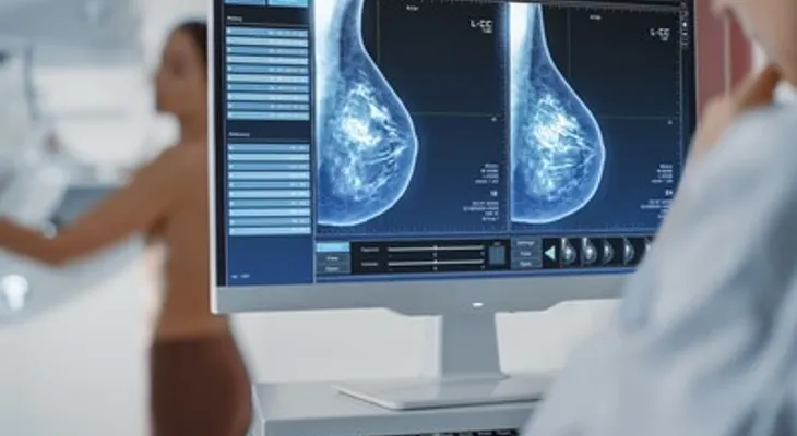 Salud Pública reporta unos 2,609 diagnósticos anuales de cáncer de mama en República Dominicana