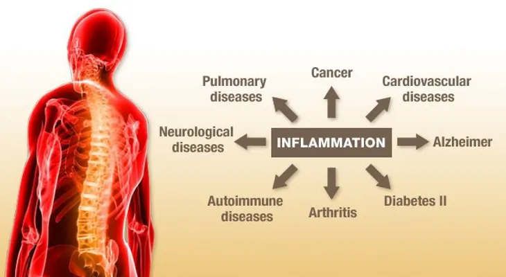 ¿inflamación y cáncer, cuál es la relación?