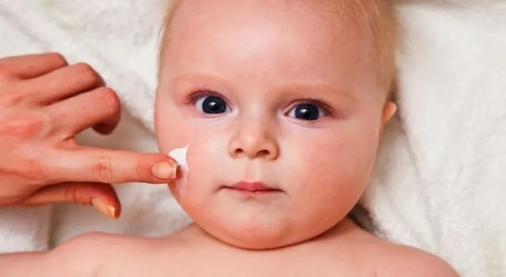 Uno de cada cuatro niños puede padecer dermatitis atópica