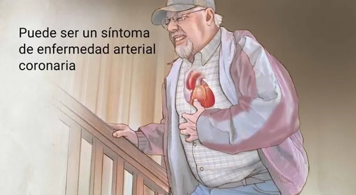 ¿Cuáles son los signos y síntomas de la angina?