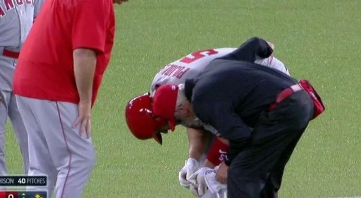 Pujols se pierde juego por golpe en una mano 