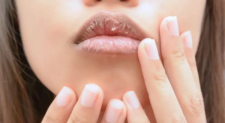 Remedios para cuidarse los labios agrietados
