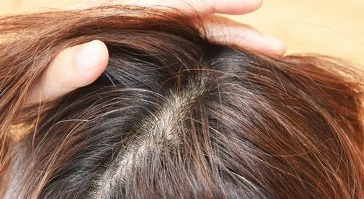 Cómo ocultar las canas fácilmente 