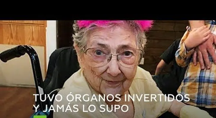 Acudió al médico por una tos, y tenía su corazón a la derecha y el hígado a la izquierda 