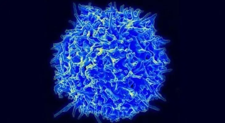La inmunoterapia T CAR es MUY eficaz en el tumor cerebral más común y letal
