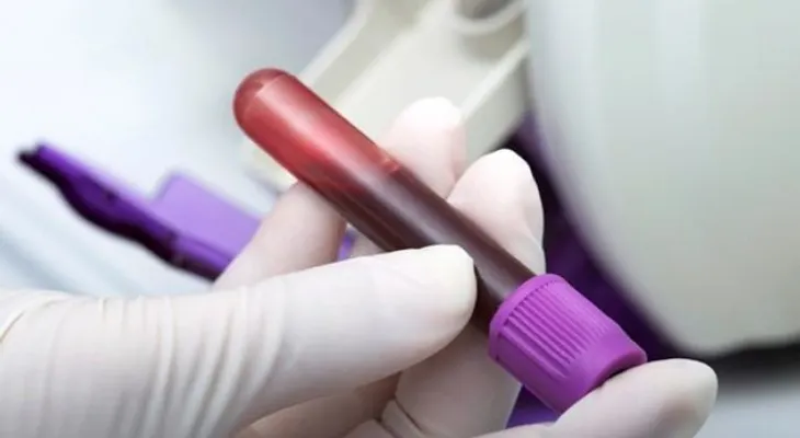 Evaluación sanguínea es clave para detectar la hemofilia 