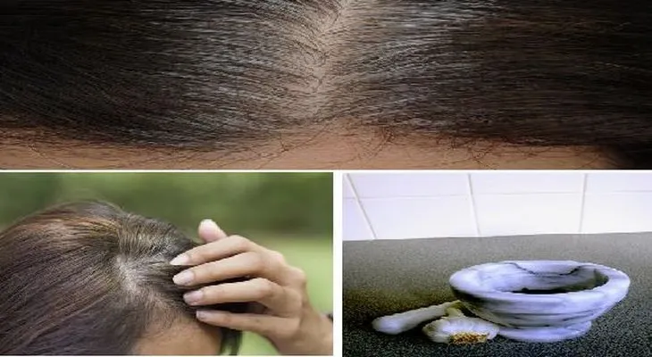 Sólo toma 5 minutos para eliminar las canas, hacer que el cabello vuelva a crecer y evitar que se caiga