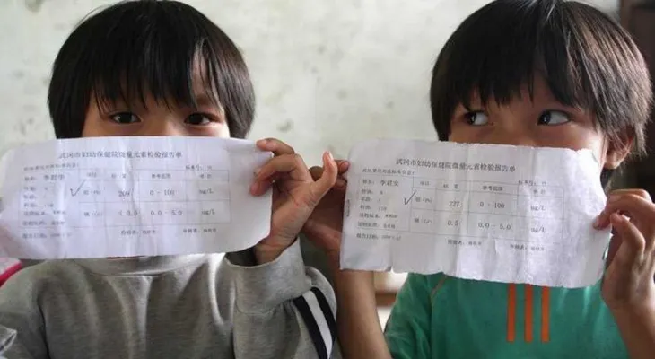 Un tercio de los niños del mundo están intoxicados con plomo, según Unicef