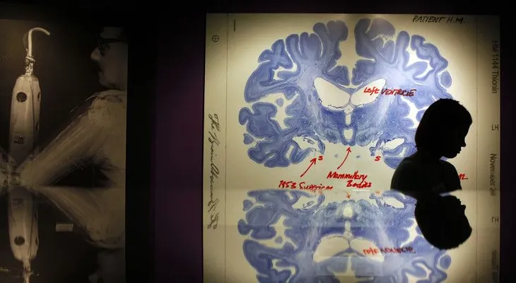 Los neurobiólogos descubren las posibles causas del alcoholismo