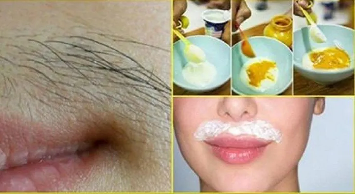 Desaparecer el molesto vello del rostro 