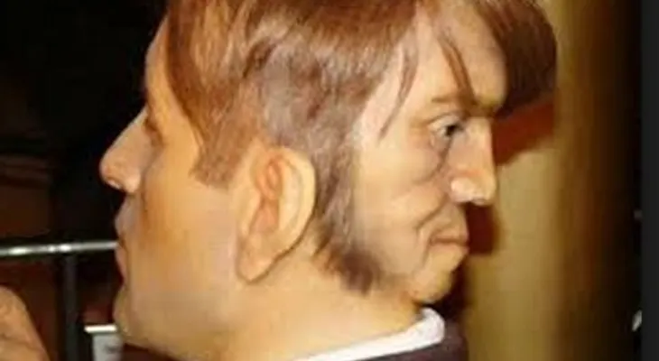 Una sorprendente historia del hombre con dos caras