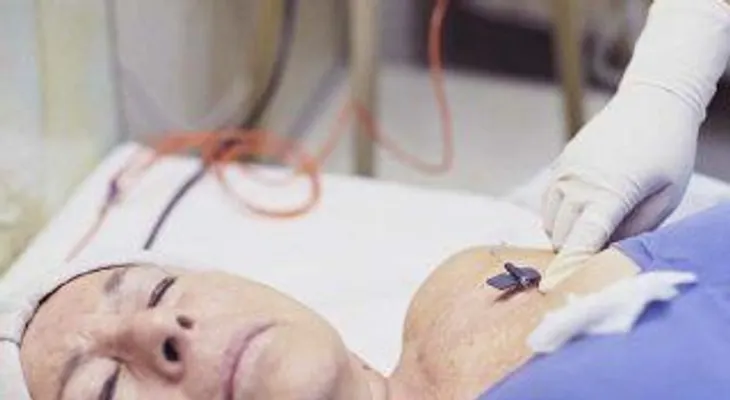 Aumenta el cáncer de mama en mujeres con implantes