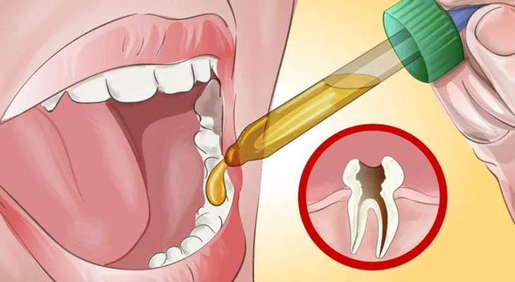 Mi dentista estaba sorprendido cuando le dije que esto me quitó el dolor de muelas ¡no lo podía creer!