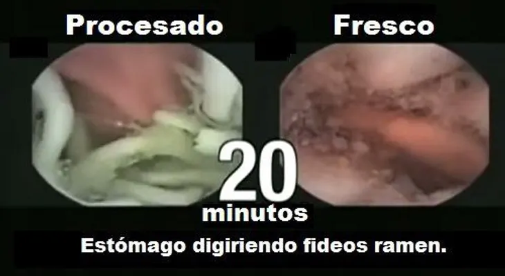 Peligros de los fideos ramen comerciales
