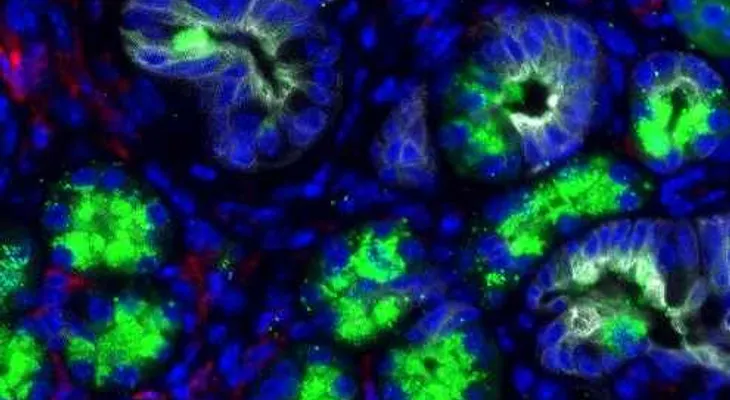 Investigadores de Clínica Mayo identifican primeros pasos en formación del cáncer de páncreas
