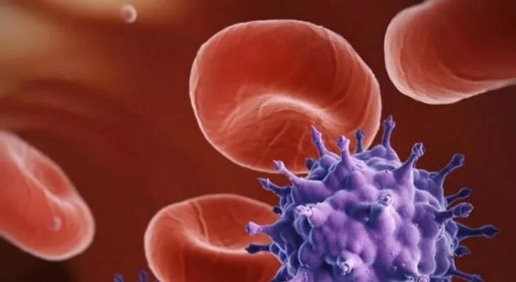 Joven francesa vence el VIH sin tratamiento médico