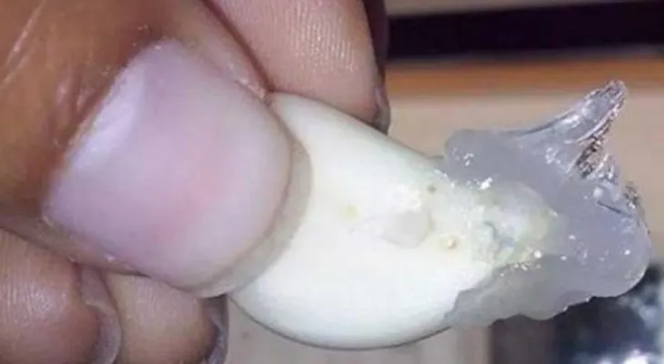 Te lamentarás por siempre si no untas un diente de ajo con Vick VapoRub, este es el mejor remedio