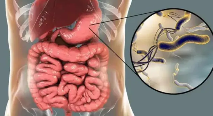 Estudio revela la gran resistencia de la Helicobacter pylori a los antibióticos